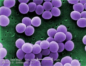 Vancomycin intermediate resistant Staphylococcus aureus (VISA).  Picture courtesy of the US Center for Disease Control and Prevention.