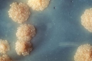 Colonies of Mycobacterium tuberculosis. Picture courtesy of the US Center for Disease Control and Prevention.